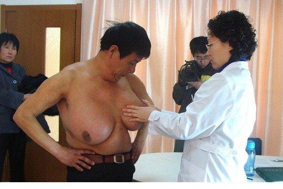 man-boob-584.jpg