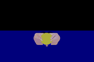 w1.gif